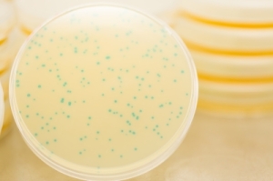 bacteria colonies in petri dish